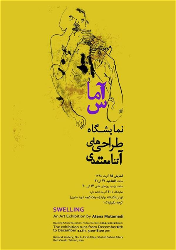 آماس